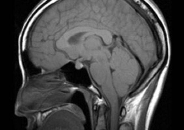 画像鑑定サービス-メディカルソリューション